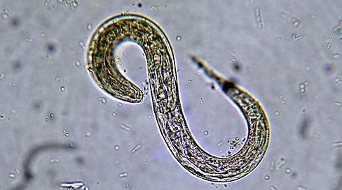 Strongyloides stercoralis