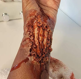 wrist.jpeg