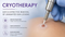 Cryotherapy is here!