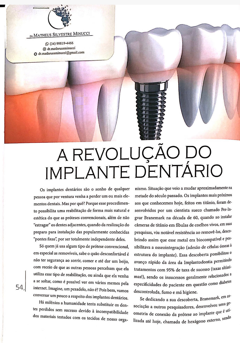 A revolução do implante dentário