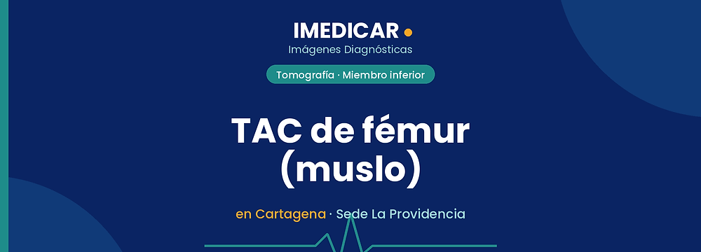TAC de fémur (muslo) en Cartagena — IMEDICAR Imágenes Diagnósticas