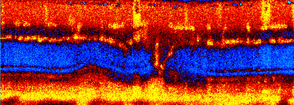 mouse angio corresponding Bscan.png