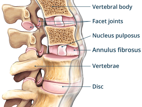 What is Mechanical Low Back Pain?