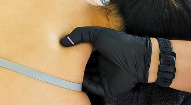 dry needle_edited.jpg