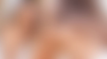 Devemos espremer espinhas? A resposta, de acordo com a ciência