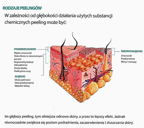 mediderma rodzaje peelingów