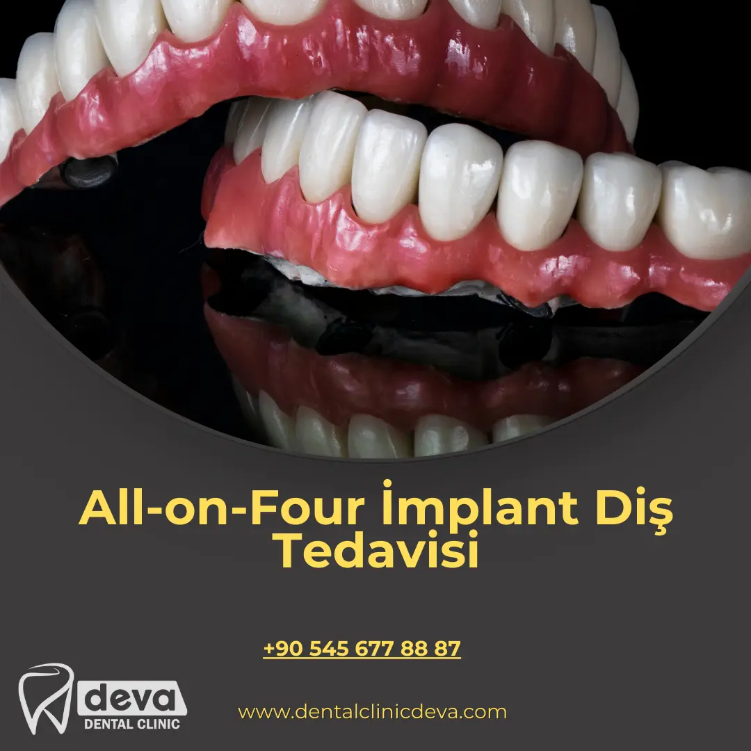 alveolit görüntüsü