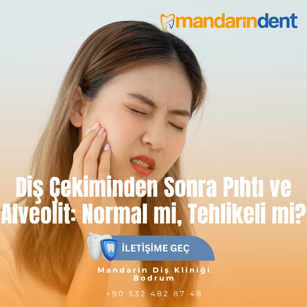 alveolit tedavisi alveolit nasıl geçer alveolit tedavi edilmezse ne olur diş çekiminden sonra enfeksiyon diş çekimi sonrası ağız kokusu