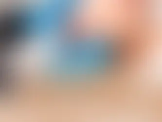 Haartransplantation mit der Hybridtechnik: Die perfekte Kombination aus DHI und Saphir