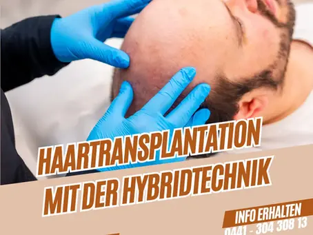 Haartransplantation mit der Hybridtechnik: Die perfekte Kombination aus DHI und Saphir