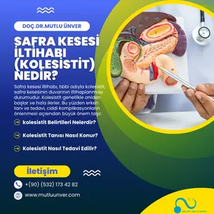 Safra Kesesi İltihabı (Kolesistit) Nedir?