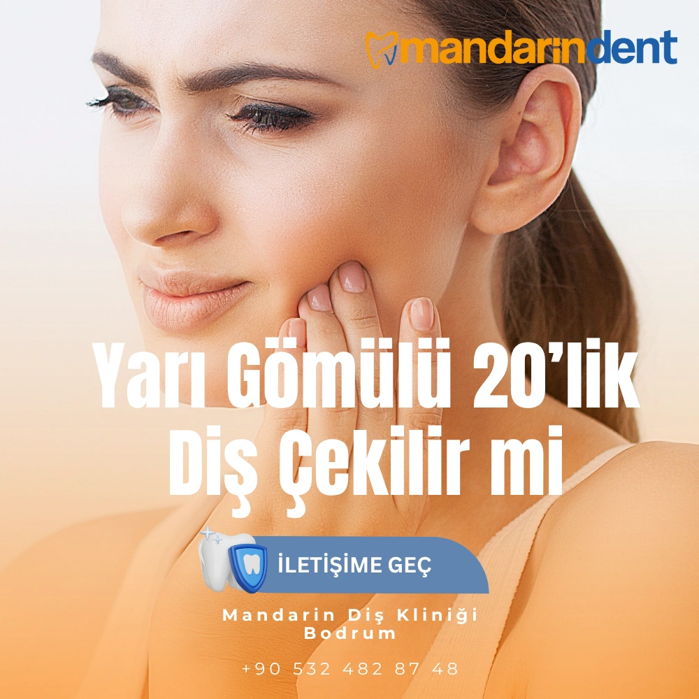 ağrımayan 20 lik diş çekilir mi