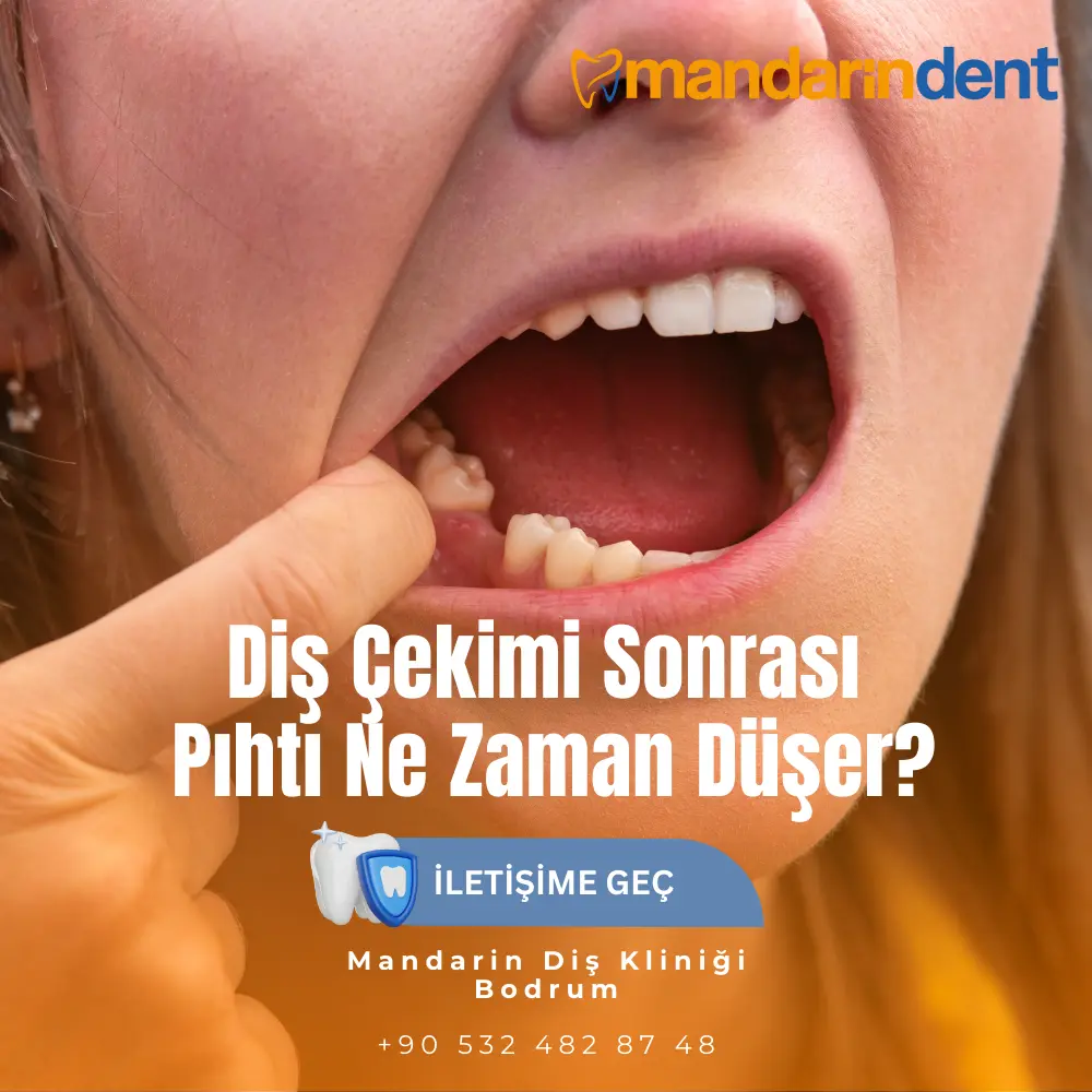kanal tedavisi sonrası yüz şişmesi