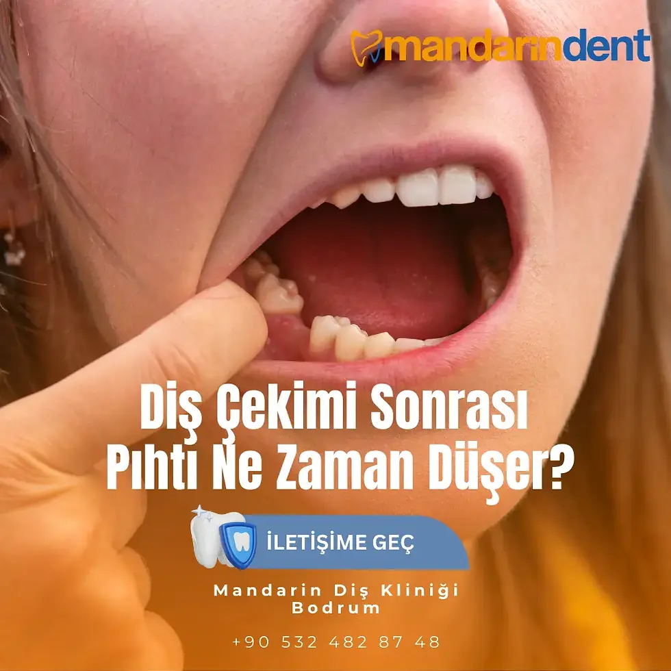 diş çekimi sonrası pıhtı ne zaman düşer
