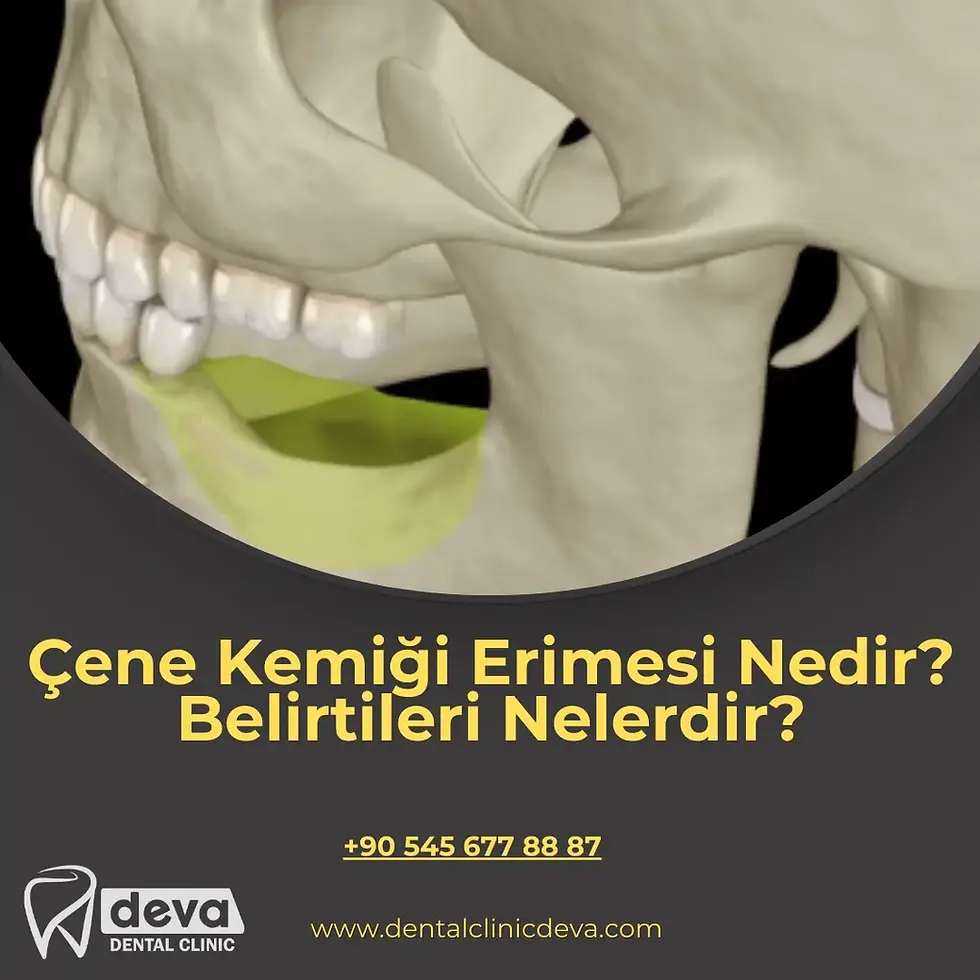 çene kemiği erimesi