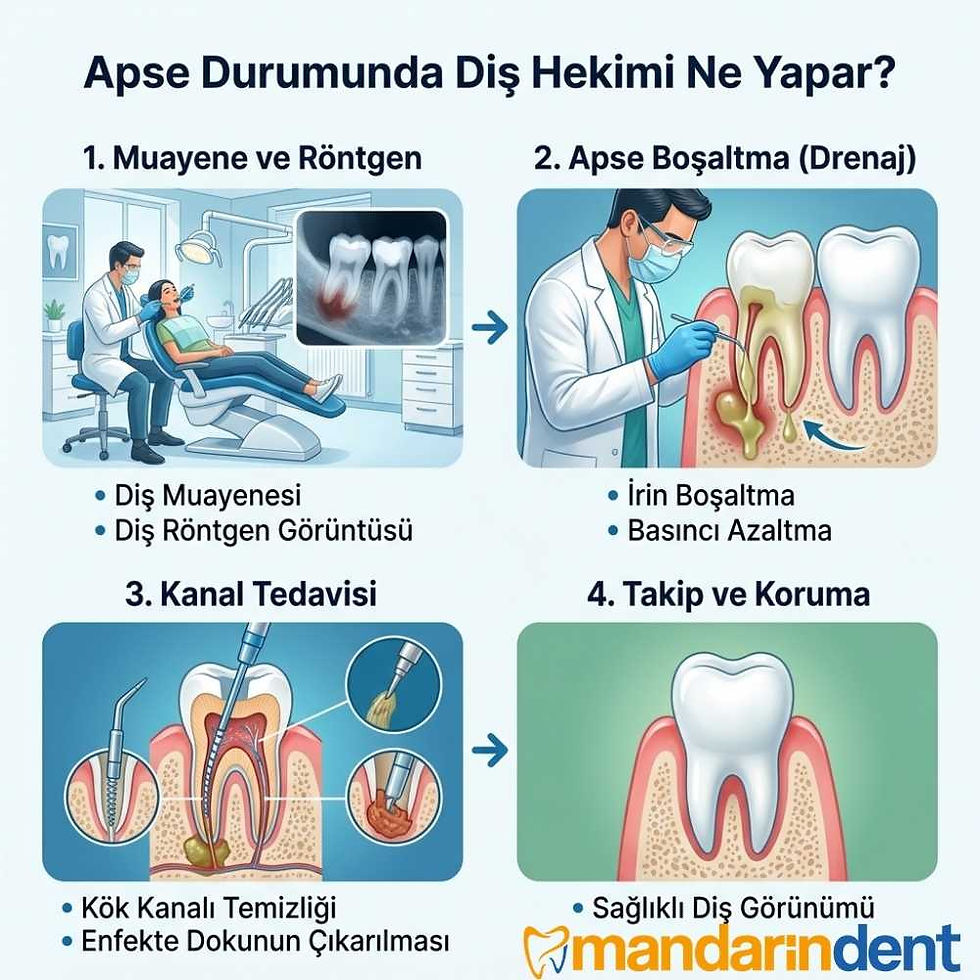 diş neden apse yapar