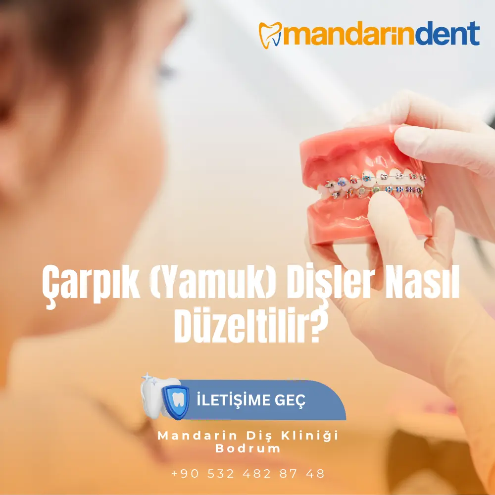Adım adım diş teli