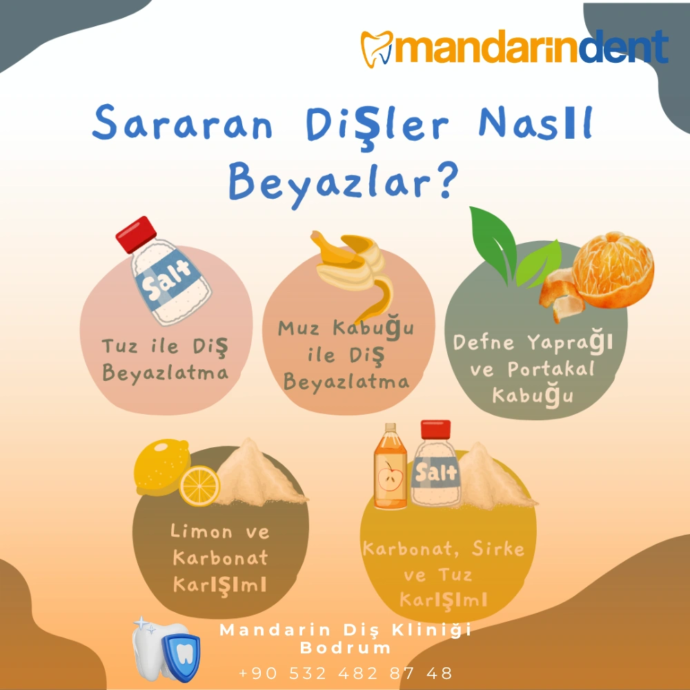 ağrımayan 20'lik diş çekilir mi