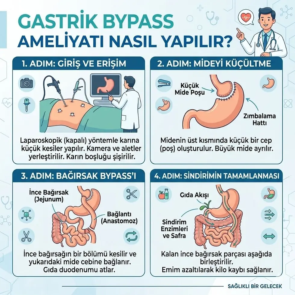gastrik bypass ameliyatı
