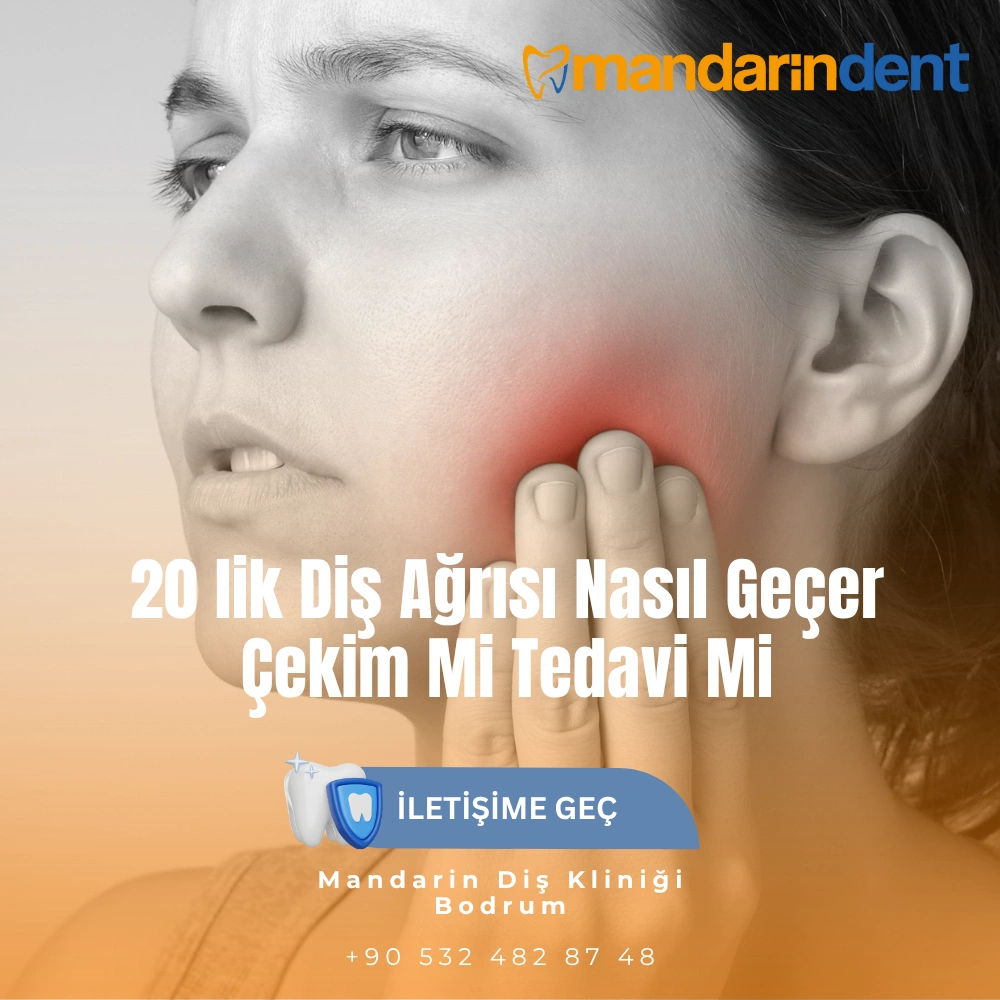 diş taşı temizliği yaptıranlar yorumları kadınlar kulübü