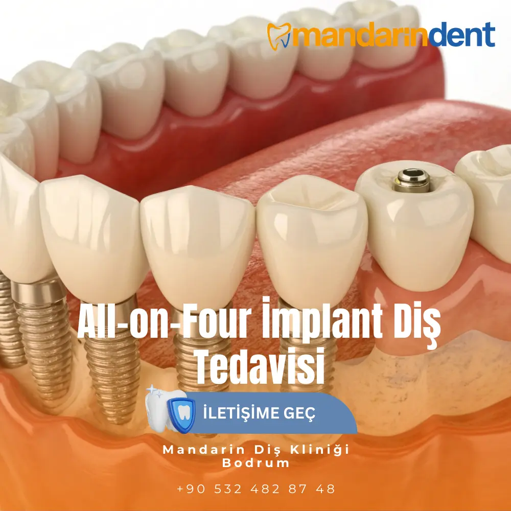  En İyi Diş Kliniği  arveles diş ağrısına iyi gelir mi