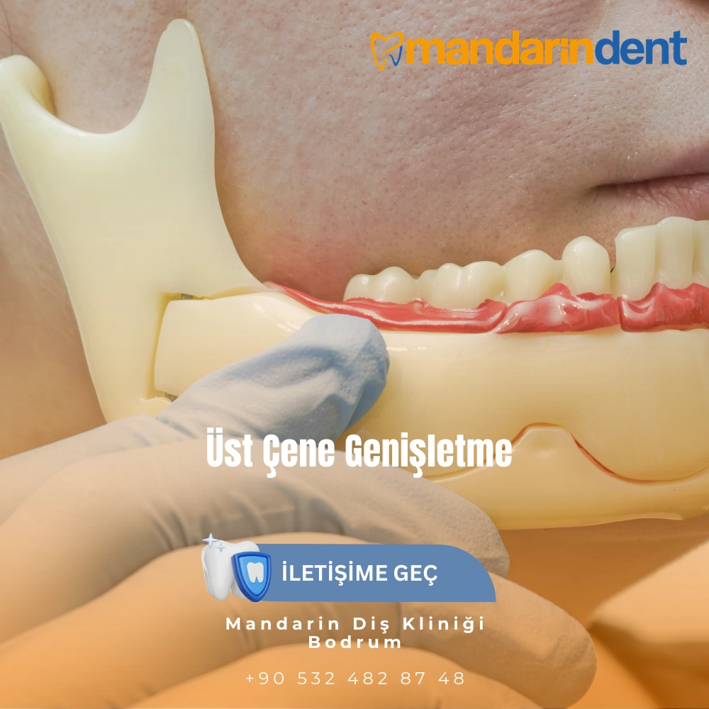 yemek yerken çeneden ses gelmesi