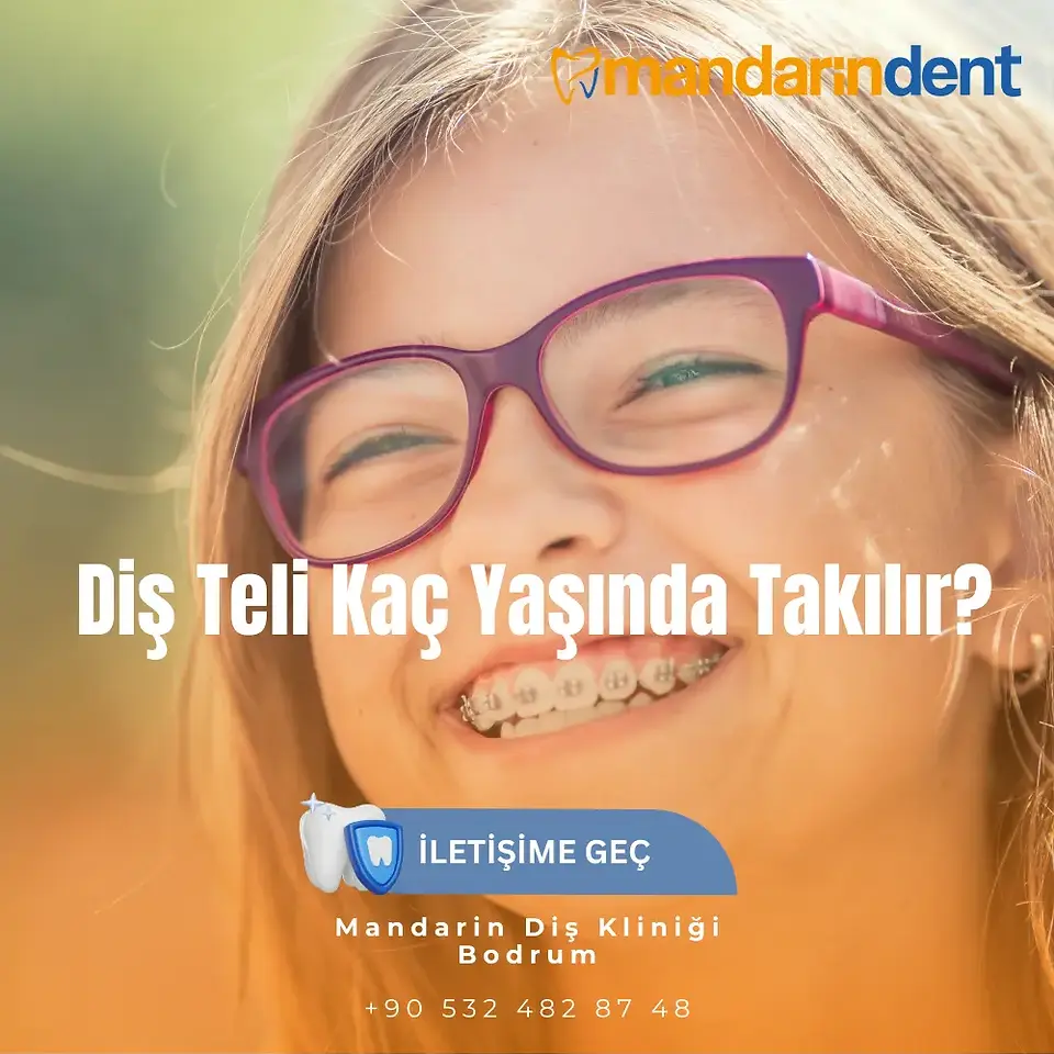 Diş teli tedavisi Aşamaları