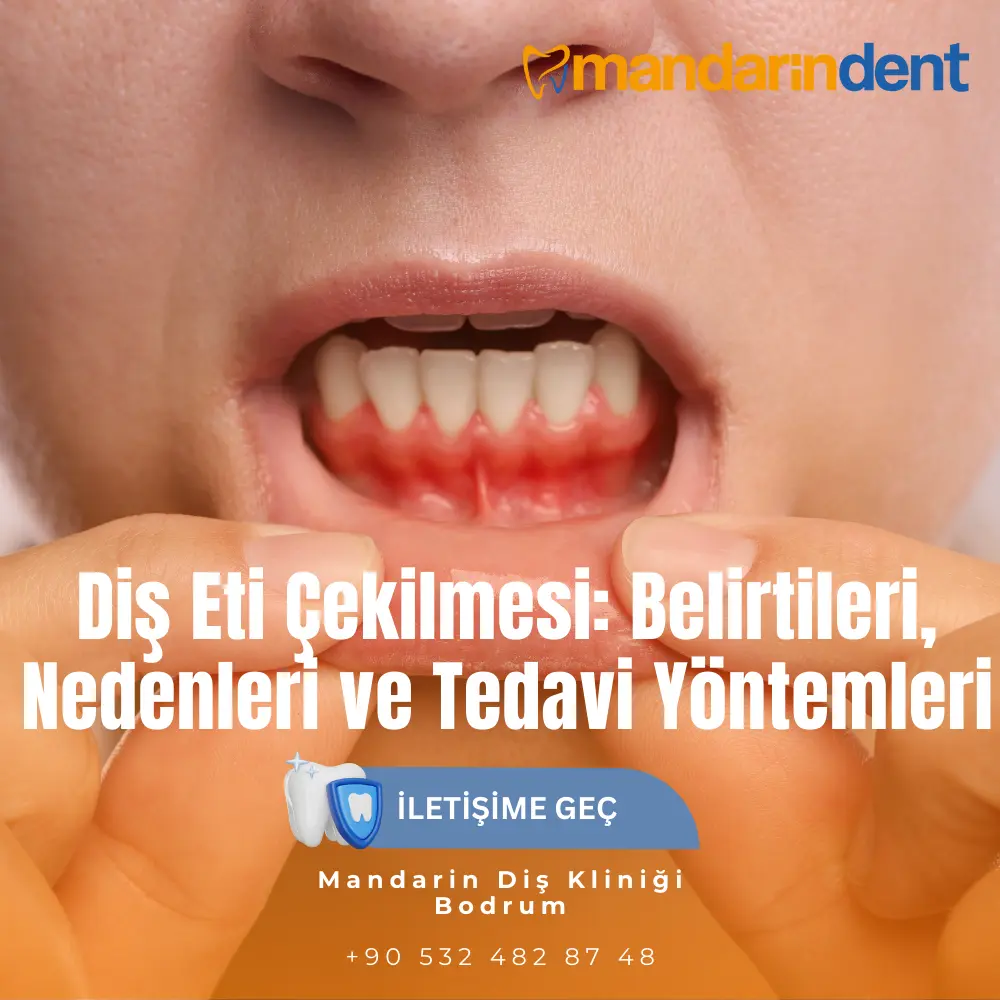 implant sonrası ağrı yorumları