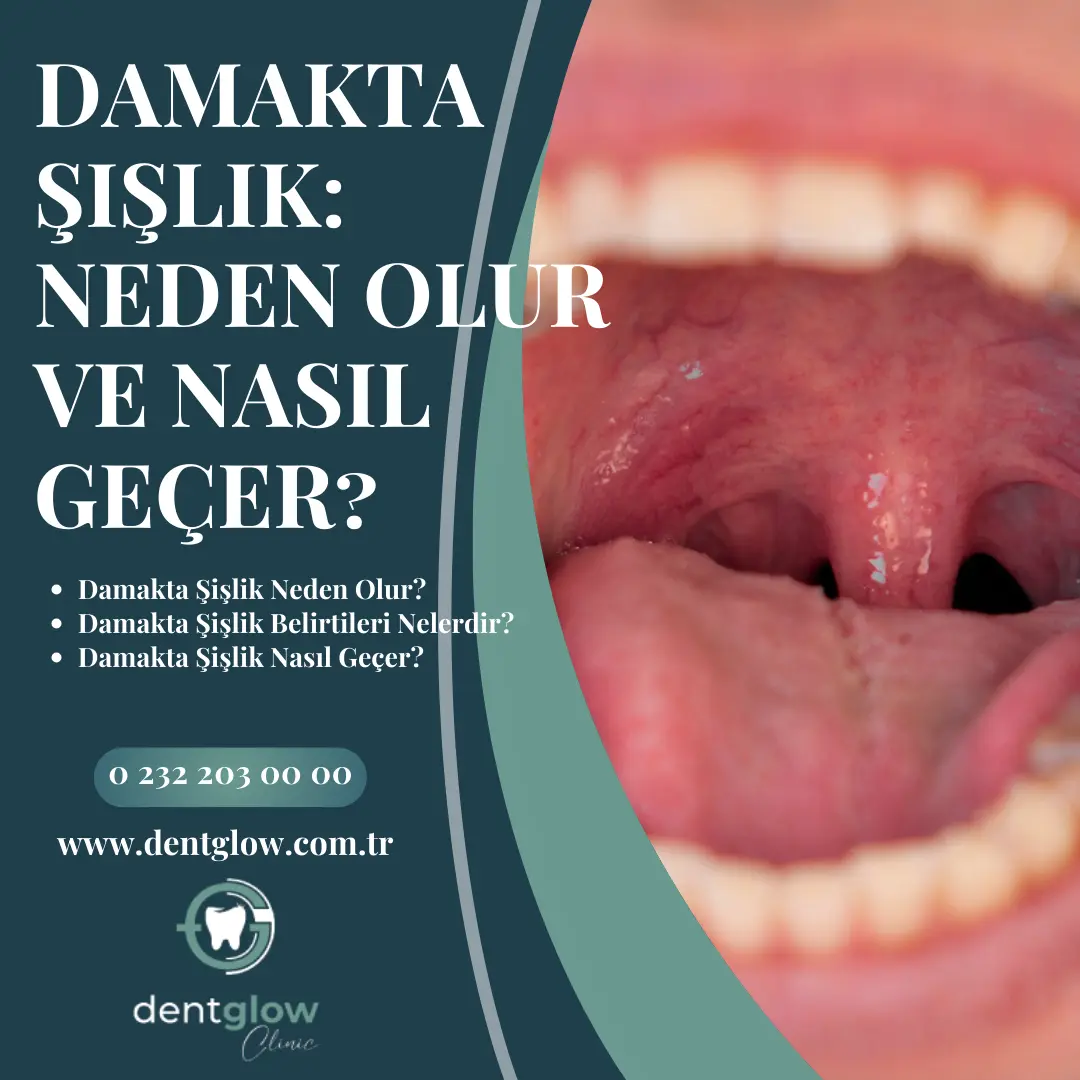diş çekimi sonrası hissizlik