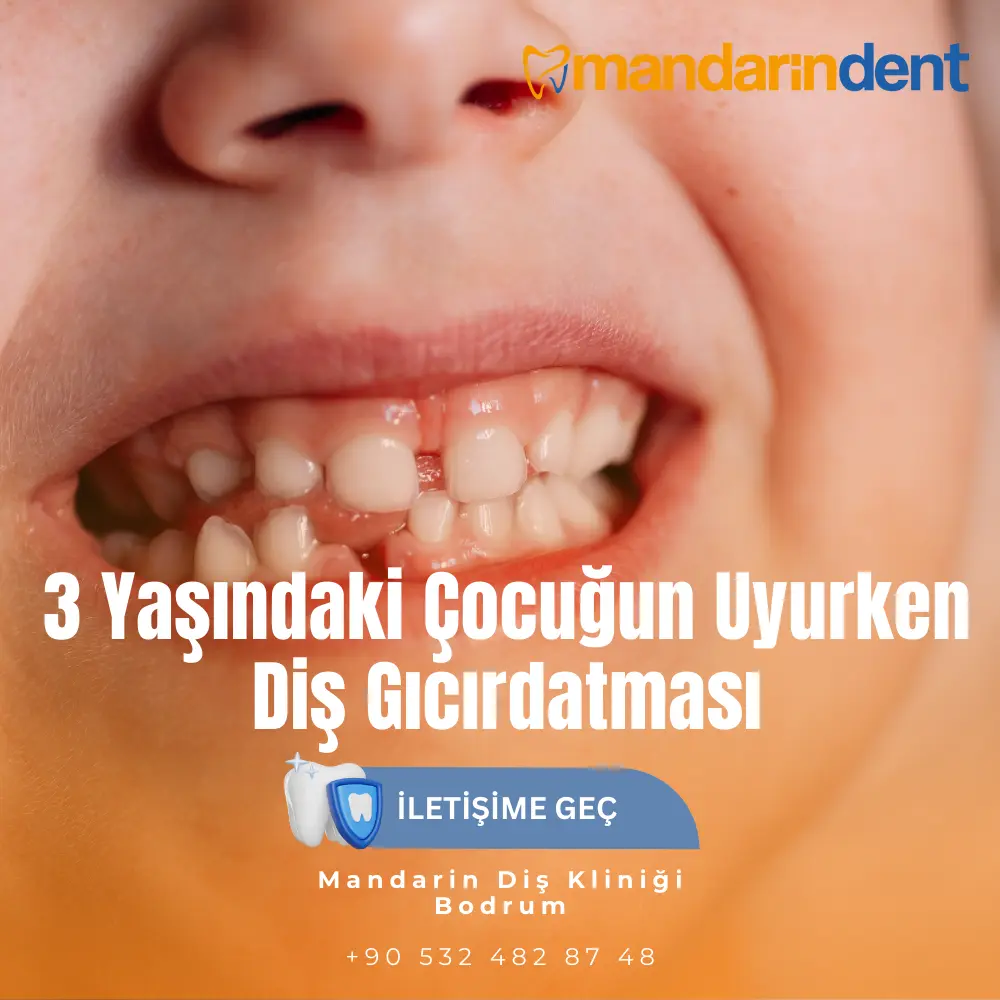 diş ağrısı ne zaman geçer