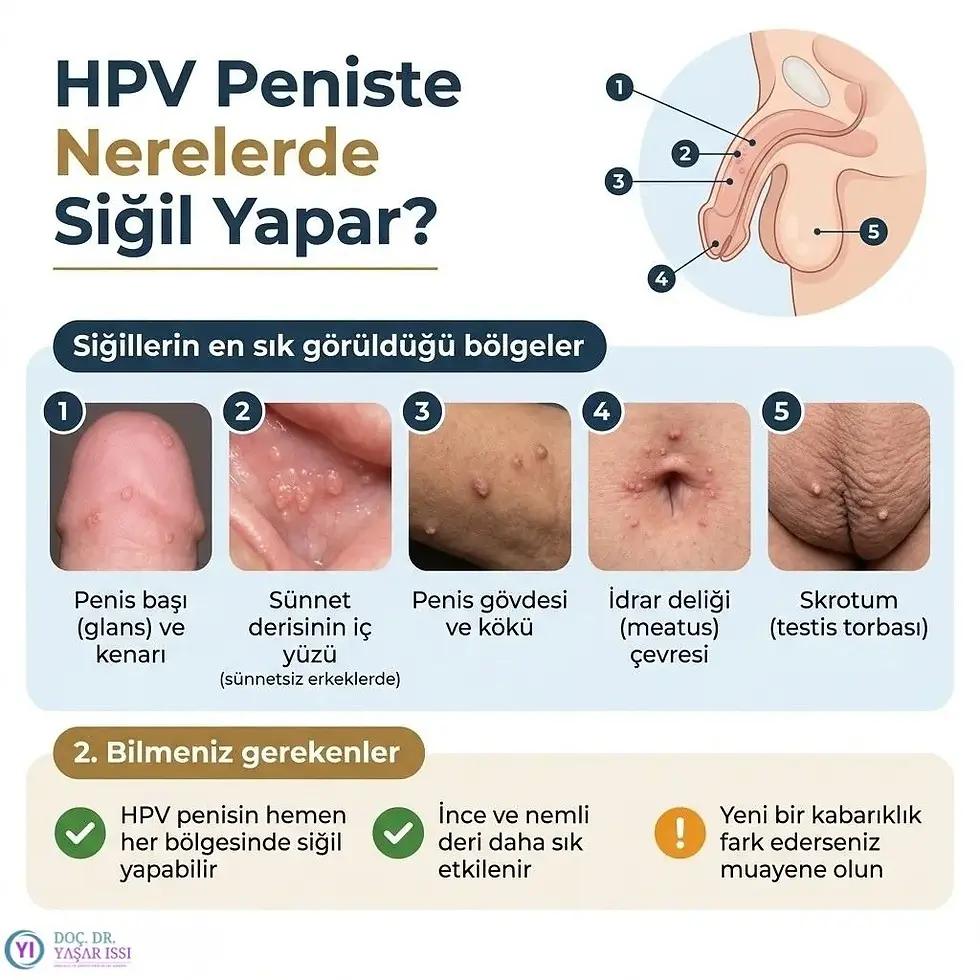 Kasıkta siğil