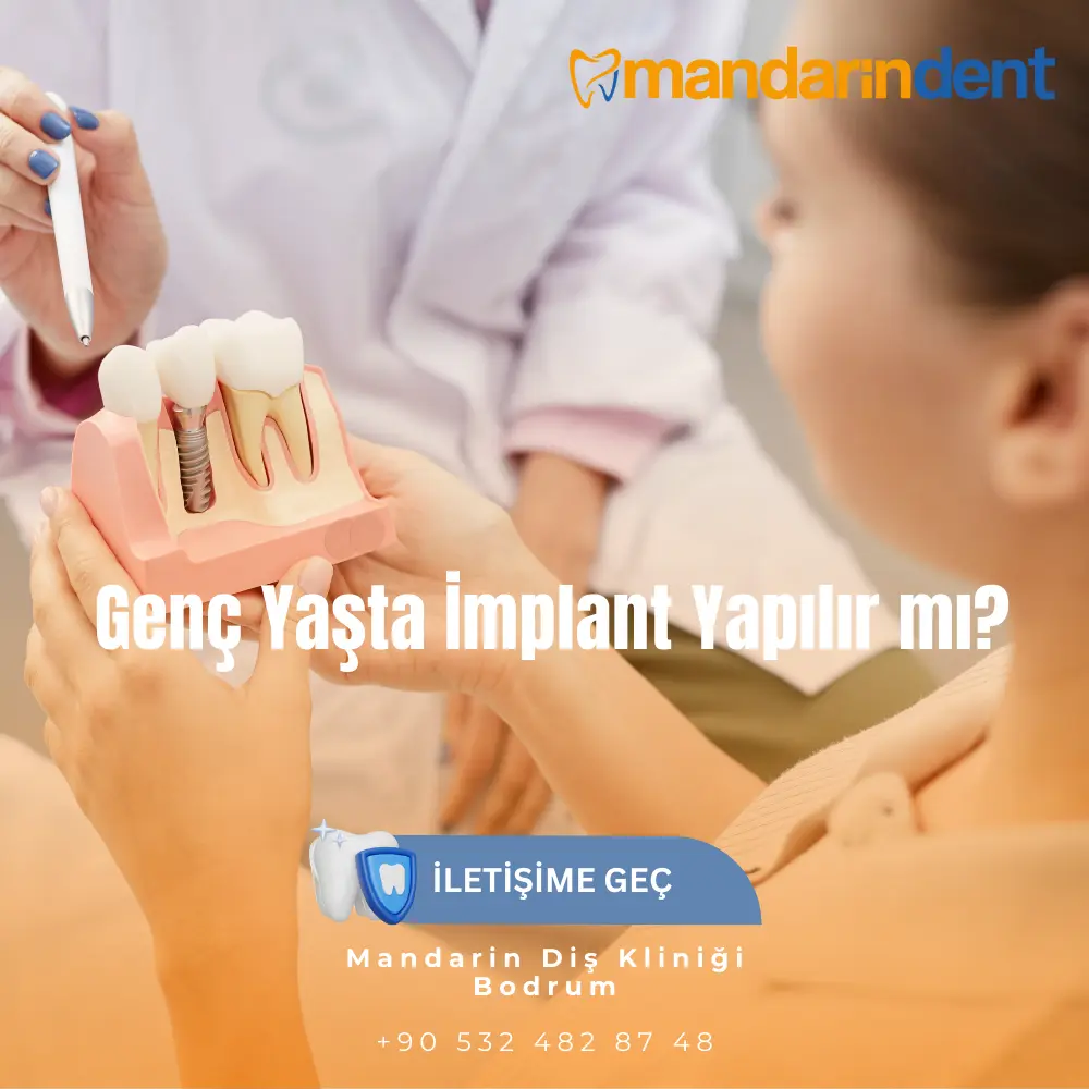 İmplanttan sonra buz Tedavisi kaç saat Süre-