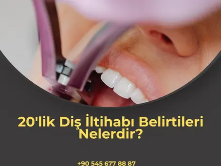 20'lik Diş İltihabı Belirtileri Nelerdir?
