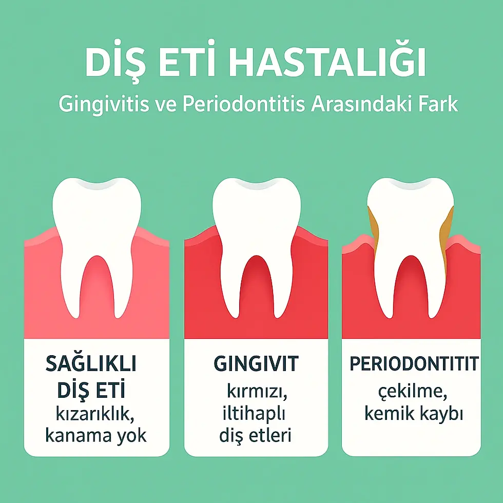 Gingivitis Ve Periodontitis Arasındaki Fark