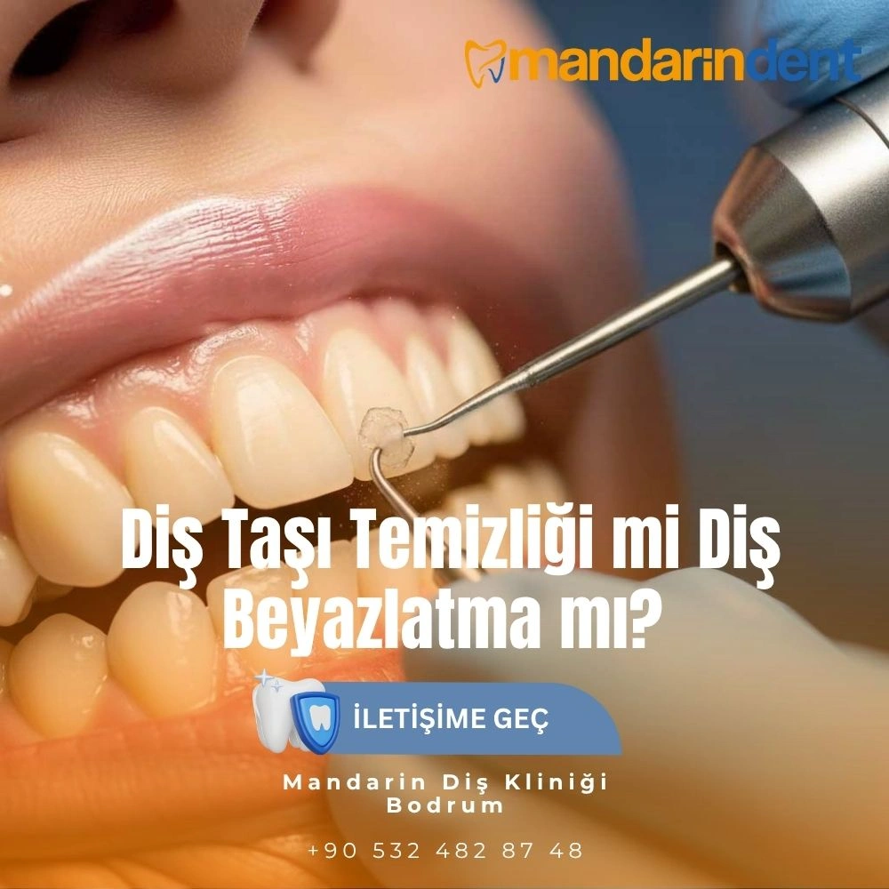 ağrımayan 20'lik diş çekilir mi