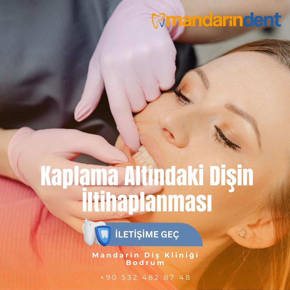 yarı gömülü 20lik diş çekimi zor mu