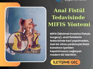 Anal fistül tedavisi için modern MIFIS yöntemi; kasları koruyan, ağrısız ve hızlı iyileşme sağlayan minimal invaziv çözüm.