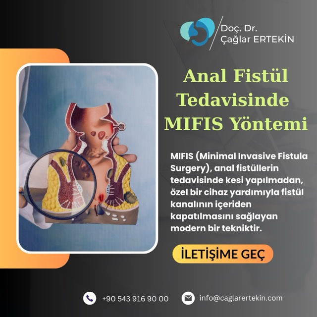 kuyruk sokumunda fistül
