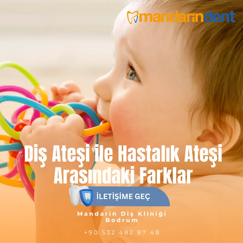 diş apsesi kendiliğinden geçer mi