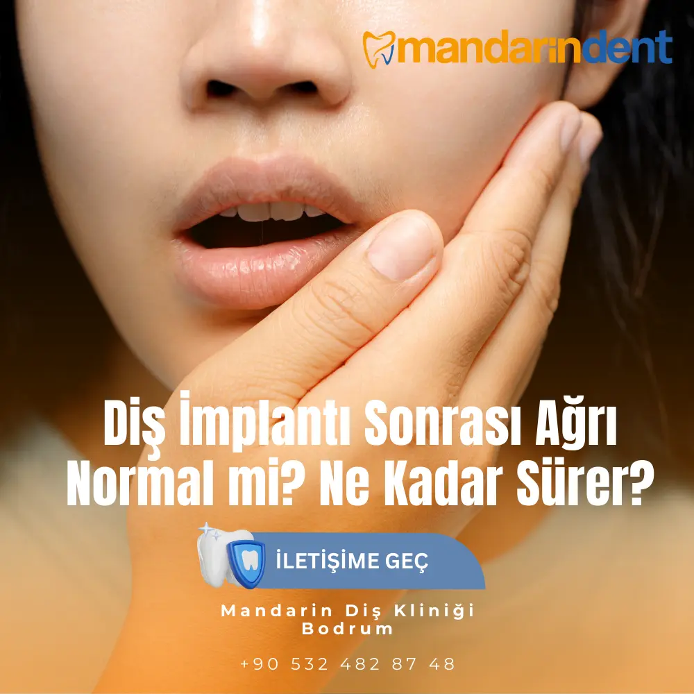  implant tedavisi ne kadar sürer