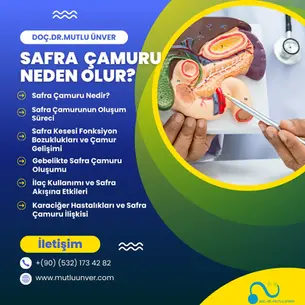 safra çamuru safra kesesi çamuru safra çamuru nedenleri safra çamuru nedir biliyer sludge safra çamuru oluşumu