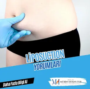 Liposuction Yorumları