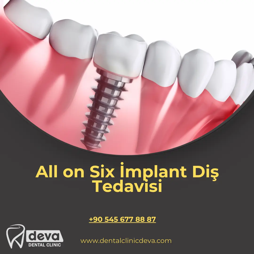 diş çekimi sonrası iltihap belirtileri