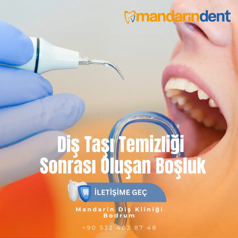 diş çekimi sonrası pıhtı oluşmaması