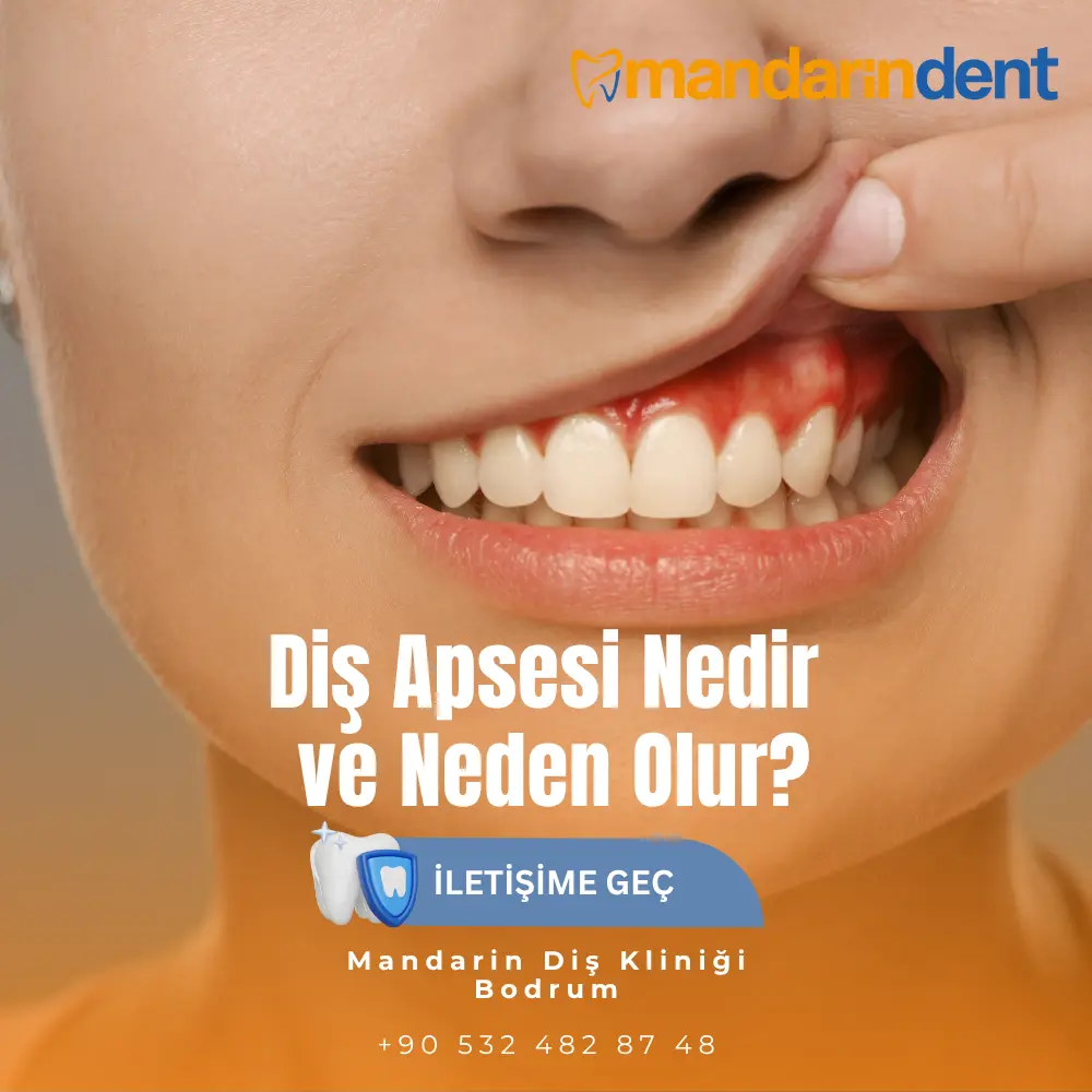 ağız kokusu neden olur