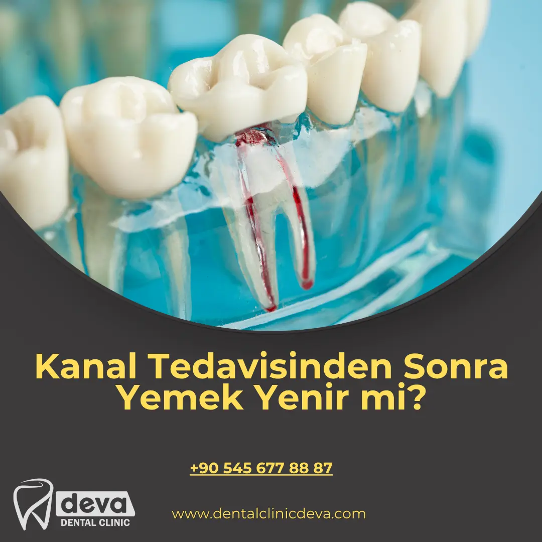 alveolit görüntüsü