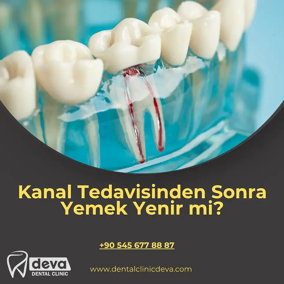 kanal tedavisinden sonra yemek yenir mi