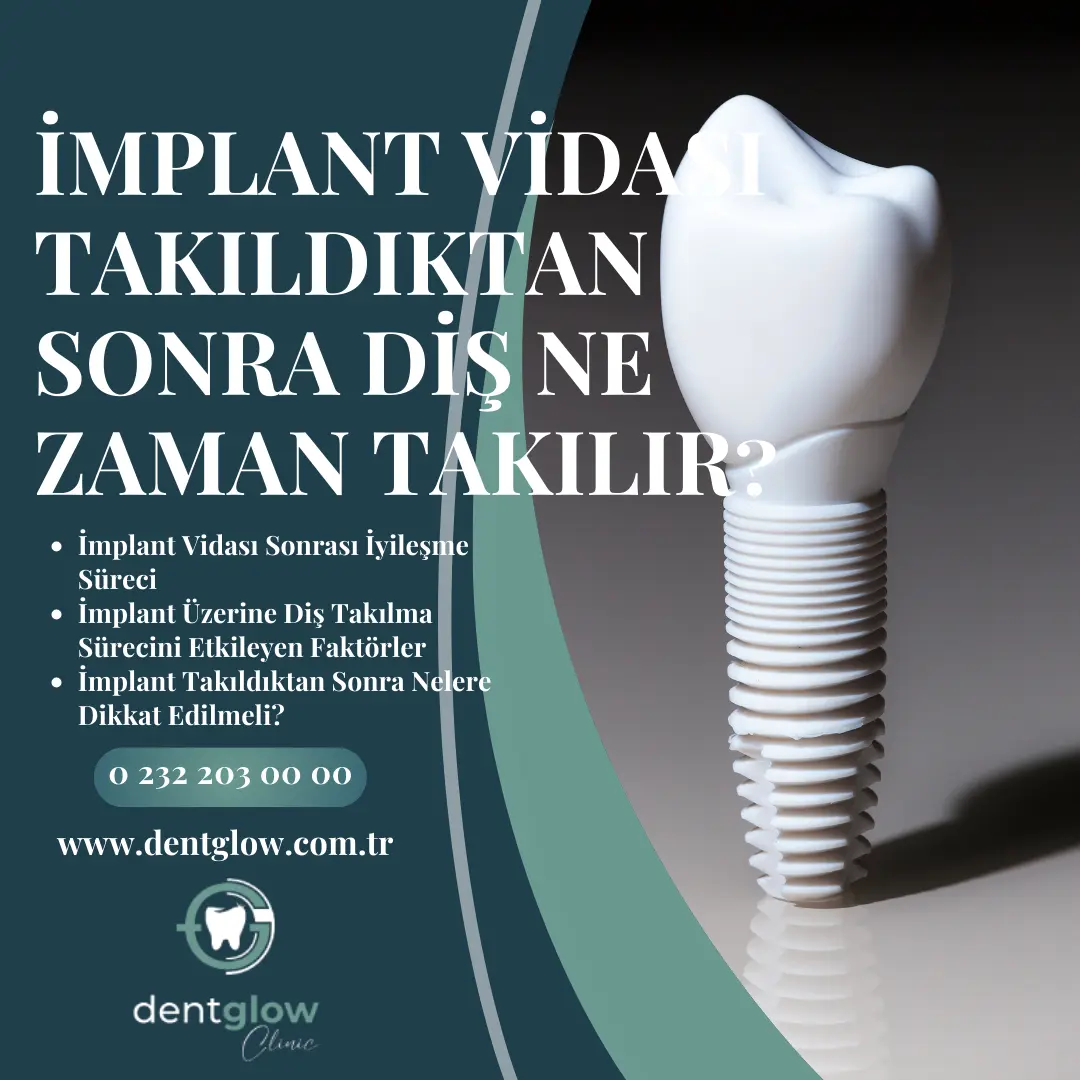 diş nasıl beyazlatılır