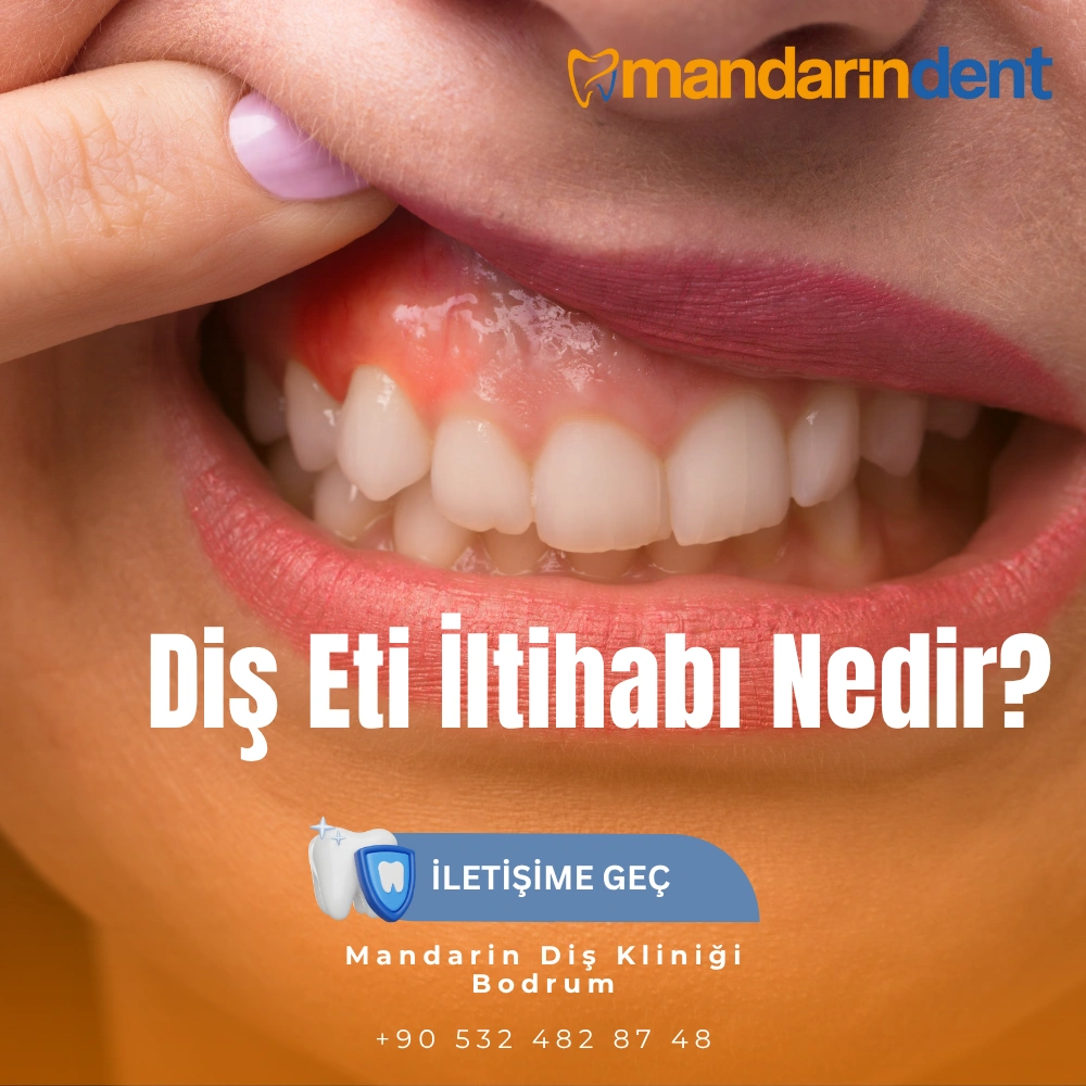 20 lik diş çekilir mi