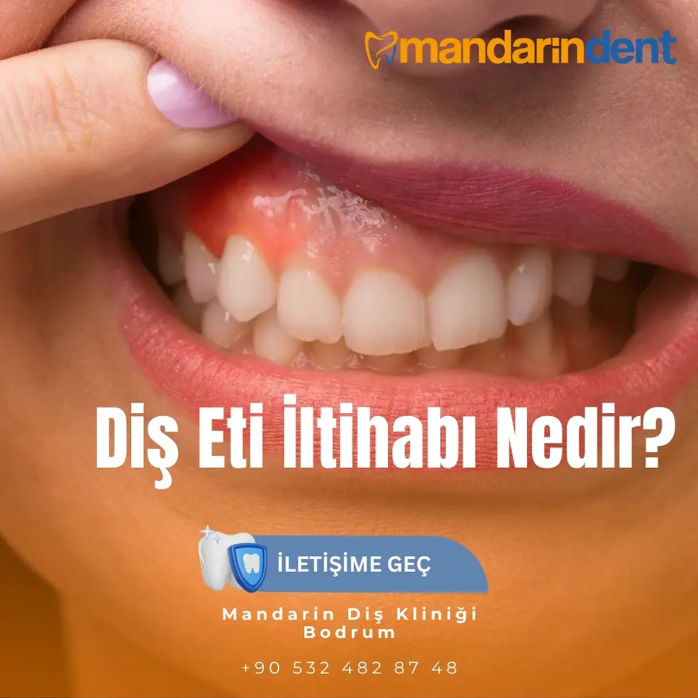 Diş Eti İltihabı Nedir